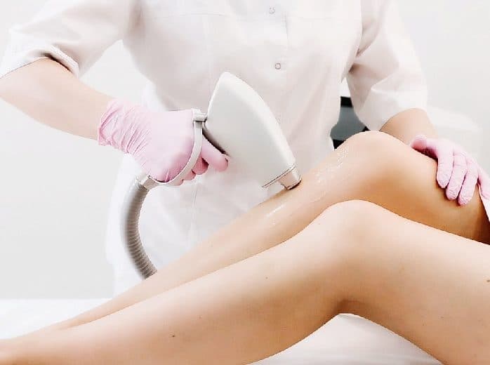 Лазерная депиляция